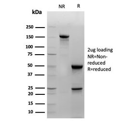 SDS-PAGE analysis of purified, BSA-free Cytokeratin 14 antibody (clone KRT14/4129) as confirmation of integrity and purity.