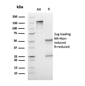 SDS-PAGE analysis of purified, BSA-free CD1a antibody (clone C1A/3249) as confirmation of integrity and purity.
