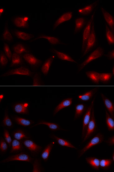 Anti-ADAM9 Antibody