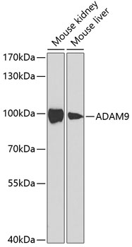 Anti-ADAM9 Antibody