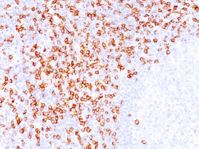 Anti-CD8A Antibody [C8/144B]