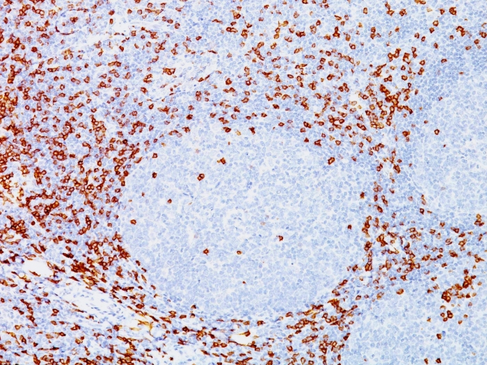 Anti-CD8A Antibody [C8/144B]