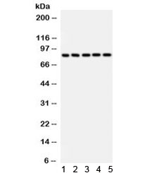 Western blot testing of rat 1) liver, 2) testis, 3) brain, and human 4) HeLa and 5) A549 lysate with SOX5 antibody. Predicted/observed molecular weight ~84 kDa.