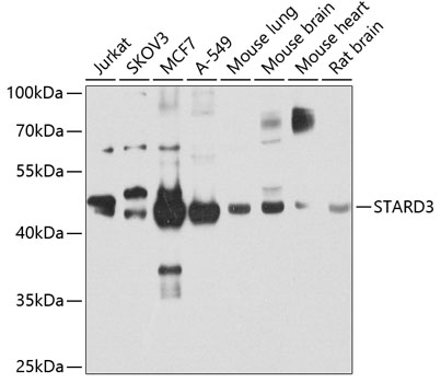 Anti-STARD3 Antibody