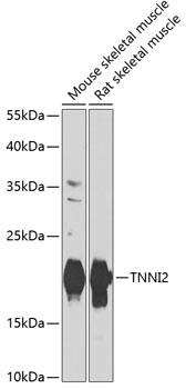 Anti-TNNI2 Antibody