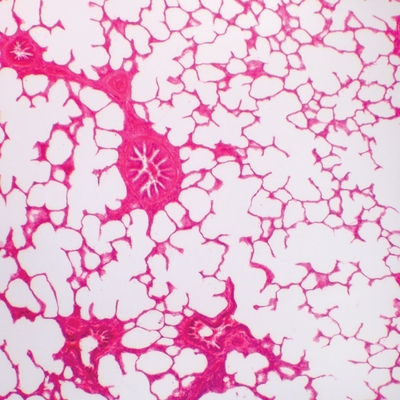 Human Lung Slide, 7 µm, H&E