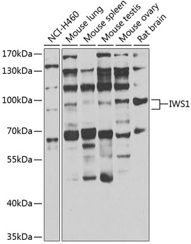 Anti-IWS1 Antibody
