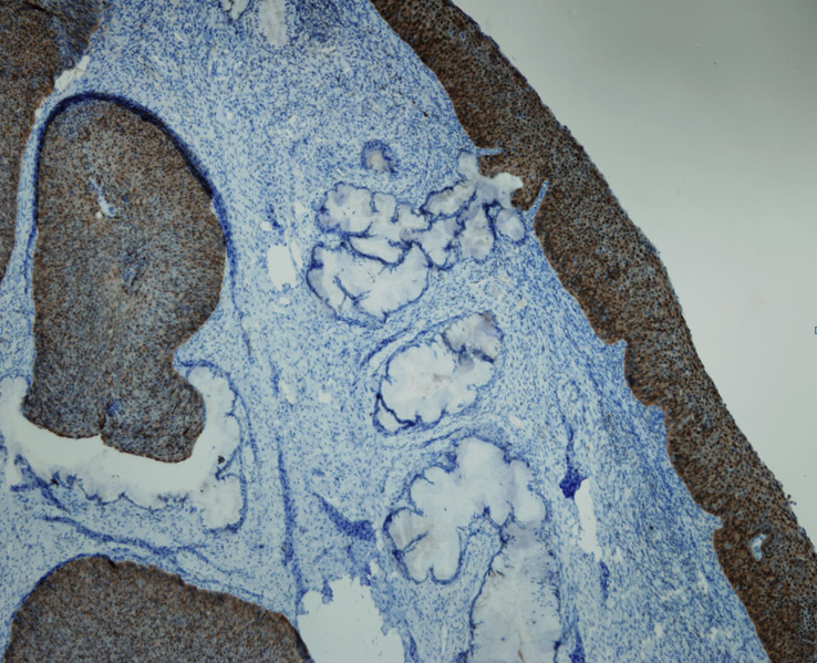 Anti-p16 Antibody [R19-D]