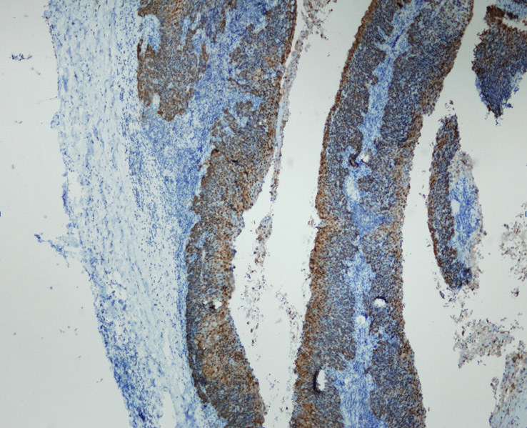 Anti-p16 Antibody [R19-D]