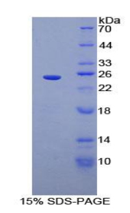 Figure. SDS-PAGE