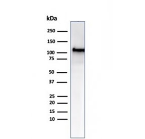 Western blot testing of human HCT-116 cell lysate using MSH2 antibody (clone MSH2/6549R). Expected molecular weight ~105 kDa.