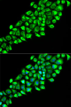 Anti-PON2 Antibody