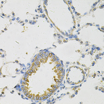 Anti-PON2 Antibody