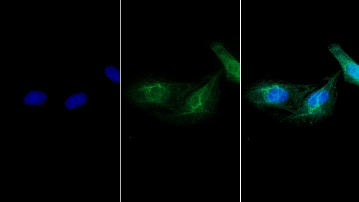 FITC staining on IF; Sample: Human U2OS cell;  Primary Ab: 30µg/ml Mouse Anti-Human MYH8 Antibody Second Ab: 2µg/ml FITC-Linked Caprine Anti-Mouse IgG Polyclonal Antibody (Catalog: SAA544Mu18)