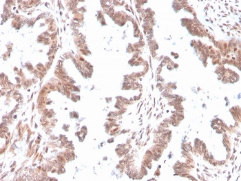 IHC staining of FFPE human ovary with GDF9 antibody. HIER: boil tissue sections in pH 9 10mM Tris with 1mM EDTA for 20 min and allow to cool before testing.
