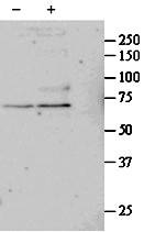 Anti-CCK4 Antibody