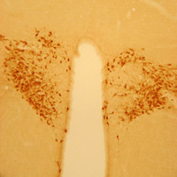 Oxytocin Antibody