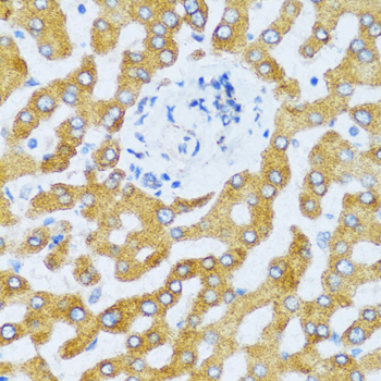 Anti-CCL25 Antibody