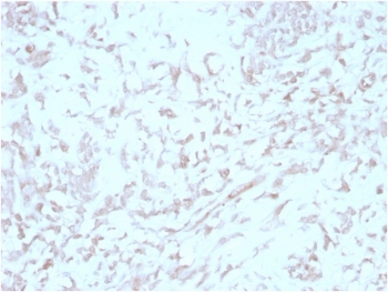 IHC staining of FFPE human liver tissue with Kindlin 2 antibody (clone 3A3). HIER: boil tissue sections in pH 9 10mM Tris with 1mM EDTA for 20 min and allow to cool before testing.