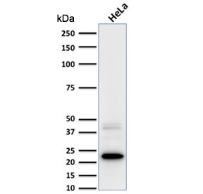Western blot testing of human HeLa cell lysate with FTL antibody. Predicted molecular weight ~20 kDa.