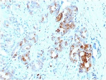 IHC testing of FFPE human prostate with FTL antibody. Required HIER: boil tissue sections in 10mM citrate buffer, pH 6, for 10-20 min and allow to cool before testing.