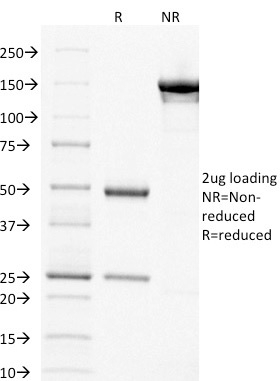 Anti-Thymidylate Synthase Antibody [TYMS/1884] - BSA and Azide free