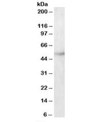 Western blot testing of HepG2 lysate with TUBB3 antibody at 2ug/ml. Predicted molecular weight: ~50kDa.