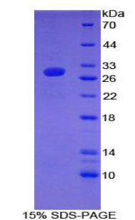 Figure. SDS-PAGE