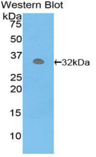 Western Blot; Sample: Recombinant protein.