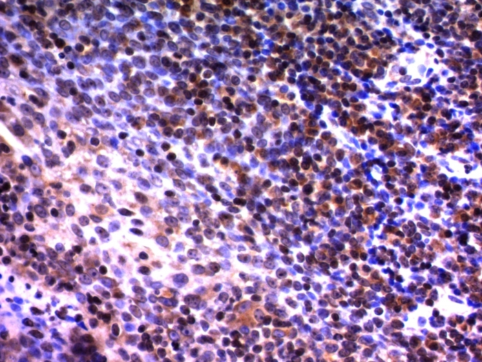 Anti-NuMA Antibody [A73-B/D12]