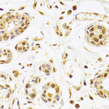 Anti-SEPHS1 Antibody