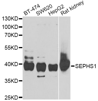 Anti-SEPHS1 Antibody
