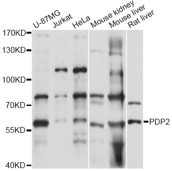 Anti-PDP2 Antibody