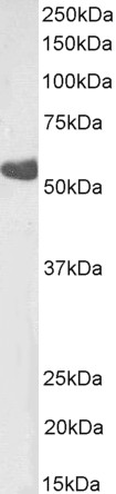 Anti-TBXA2R Antibody
