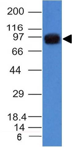 Anti-UACA Antibody [UACA/1222]