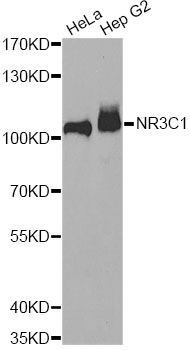 Anti-NR3C1 Antibody