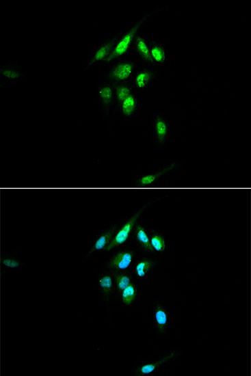Anti-NR3C1 Antibody