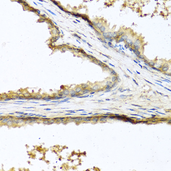 Anti-SOST Antibody