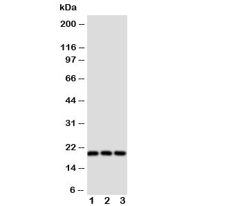 Western blot testing of Thy1 antibody and Lane 1: rat brain; 2: rat liver; 3: rat thymus tissue lysate