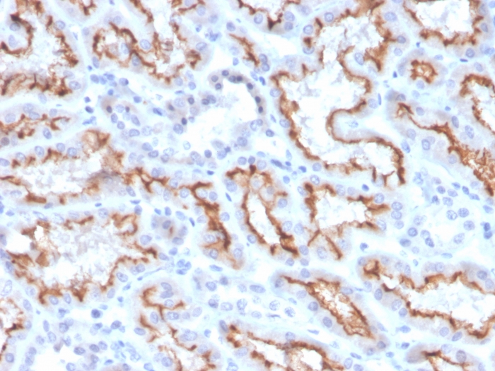 Anti-Interferon gamma Antibody [IFNG/3996R]