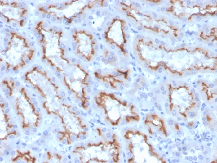 Anti-Interferon gamma Antibody [IFNG/3996R]