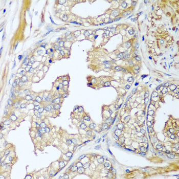 Anti-CFD Antibody