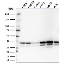 Western blot testing of human samples with MDH1 antibody. Predicted molecular weight: ~36 kDa.