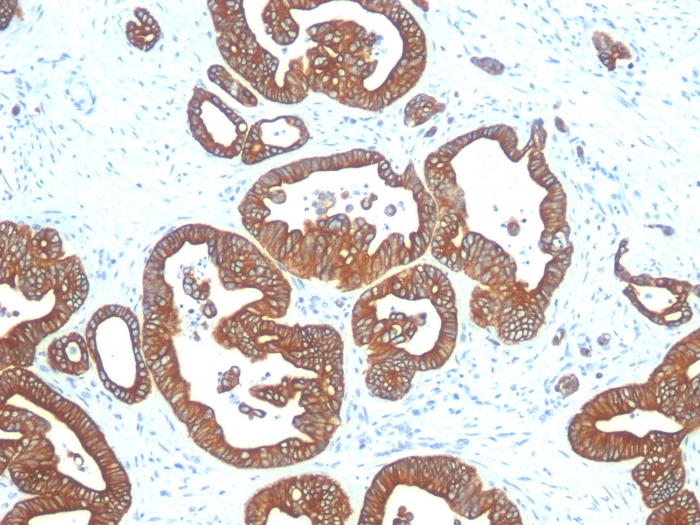 Anti-Cytokeratin 18 Antibody [DE-K18]