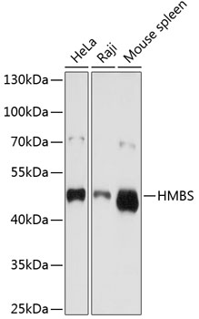 Anti-HMBS Antibody