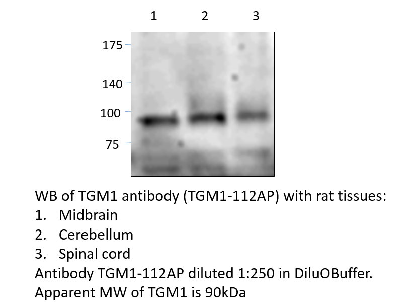 Anti-TGM1 Antibody