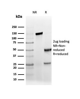 Anti-AMACR Antibody [rAMACR/6369]