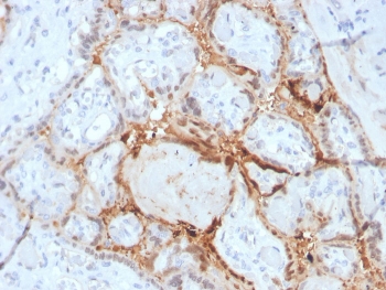 IHC staining of FFPE human placenta with HIF1 alpha antibody (clone Ha111a). HIER: boil tissue sections in pH 9 10mM Tris with 1mM EDTA for 20 min and allow to cool before testing.