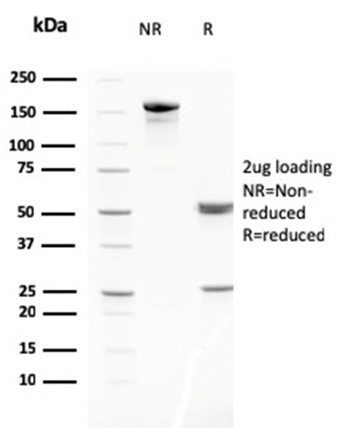 Anti-MMP3 Antibody [MMP3/2806] - BSA and Azide free