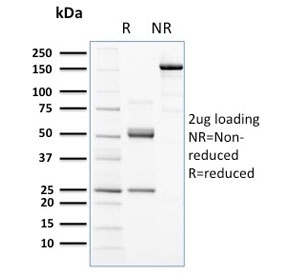 SDS-PAGE analysis of purified, BSA-free CD117 antibody (clone KIT/2672) as confirmation of integrity and purity.